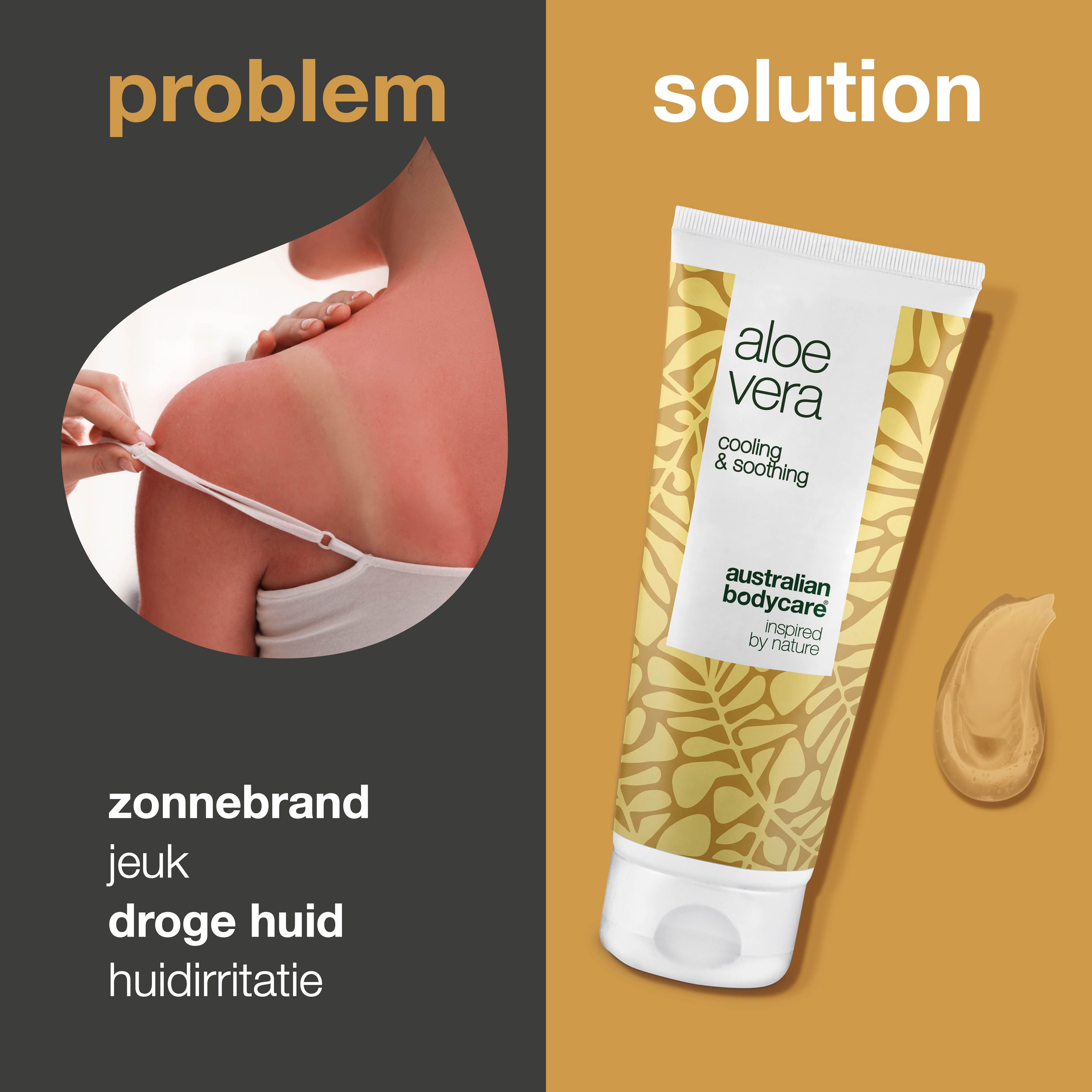Vergelijking: zonnebrand vs. aloë vera gel. Tube met tekst: Aloe Vera, Cooling & Soothing, Australian Bodycare.