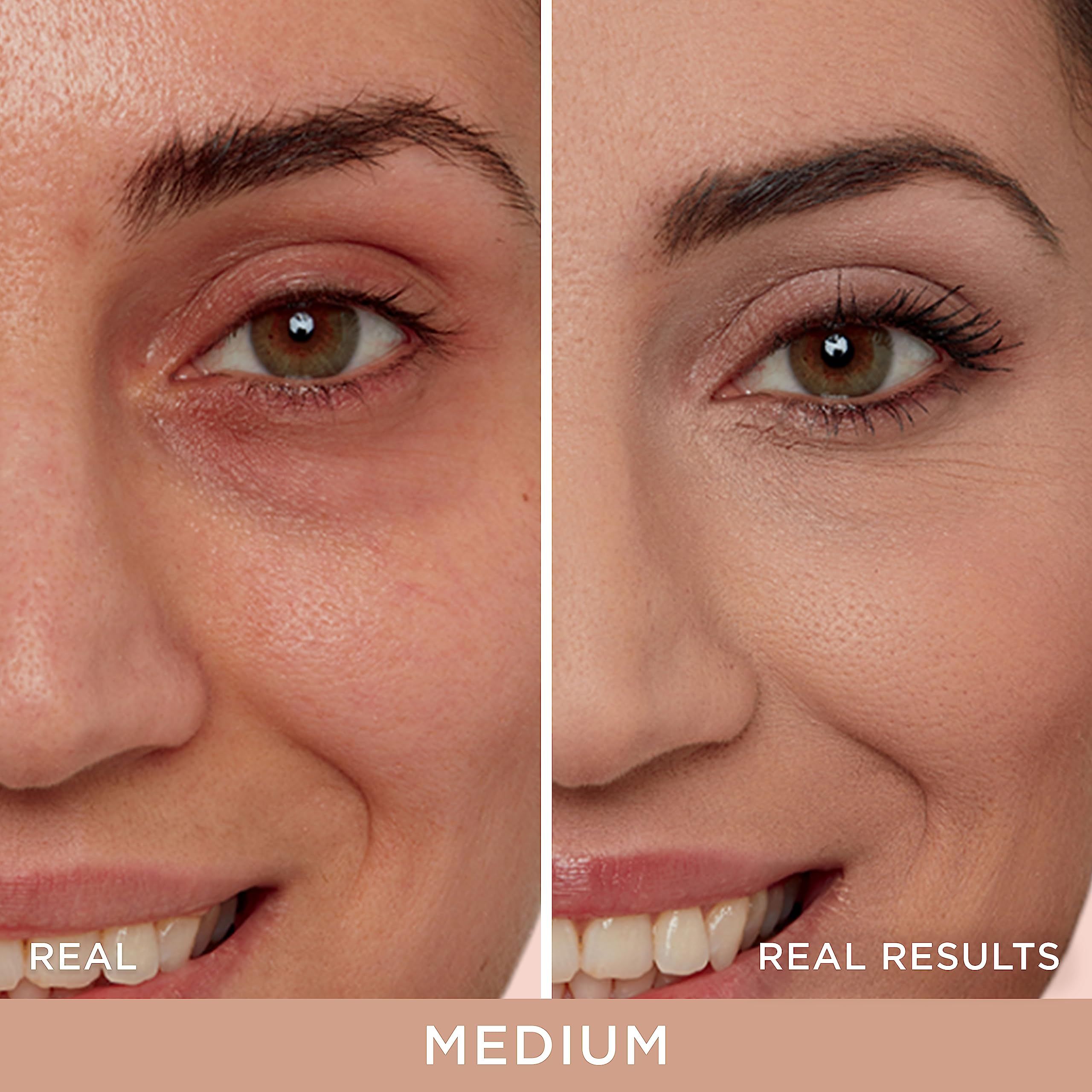 Vorher-Nachher-Vergleich eines Gesichts. Bereiche: Augenpartie. Text: REAL RESULTS. Farbton: MEDIUM.