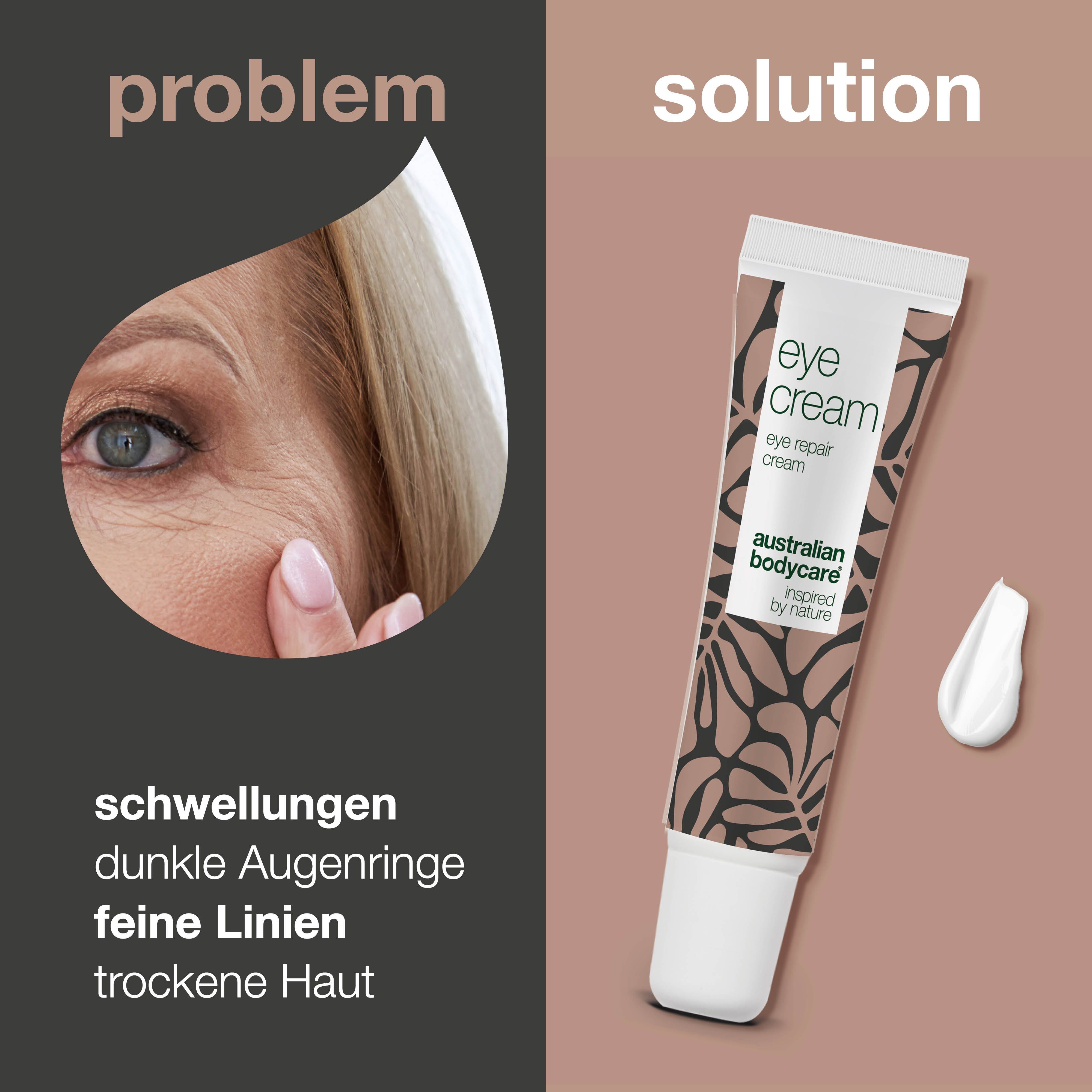 Vergleich: Auge mit Falten, Tube Augencreme, Klecks Creme. Text: Augenringe, Tränensäcke, feine Linien, trockene Haut.