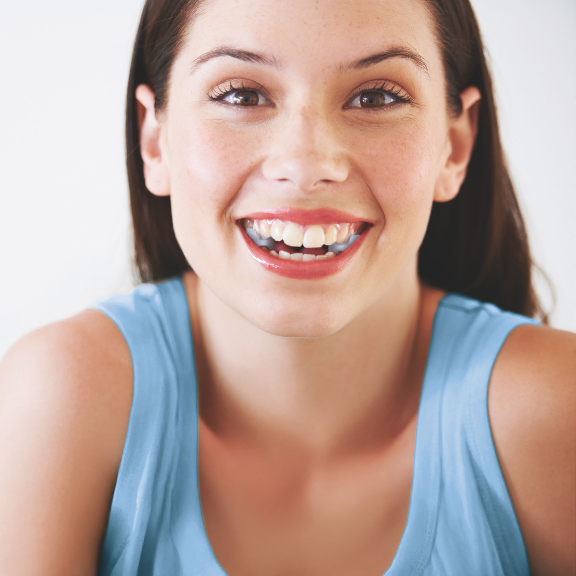 Lächelnde Frau mit TJ-Motion Aligner im Mund. Der Aligner ist transparent und kaum sichtbar.