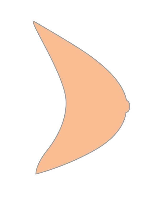 Illustration einer Brustprothese. Seitenansicht, hautfarben, mit angedeuteter Brustwarze.