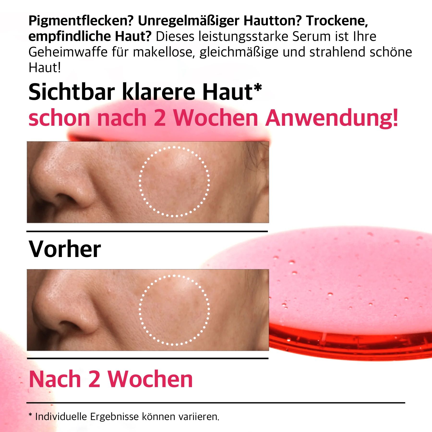Vorher-Nachher-Vergleich von Haut. Text: Sichtbar klarere Haut nach 2 Wochen Anwendung. Anua 10+ Serum.