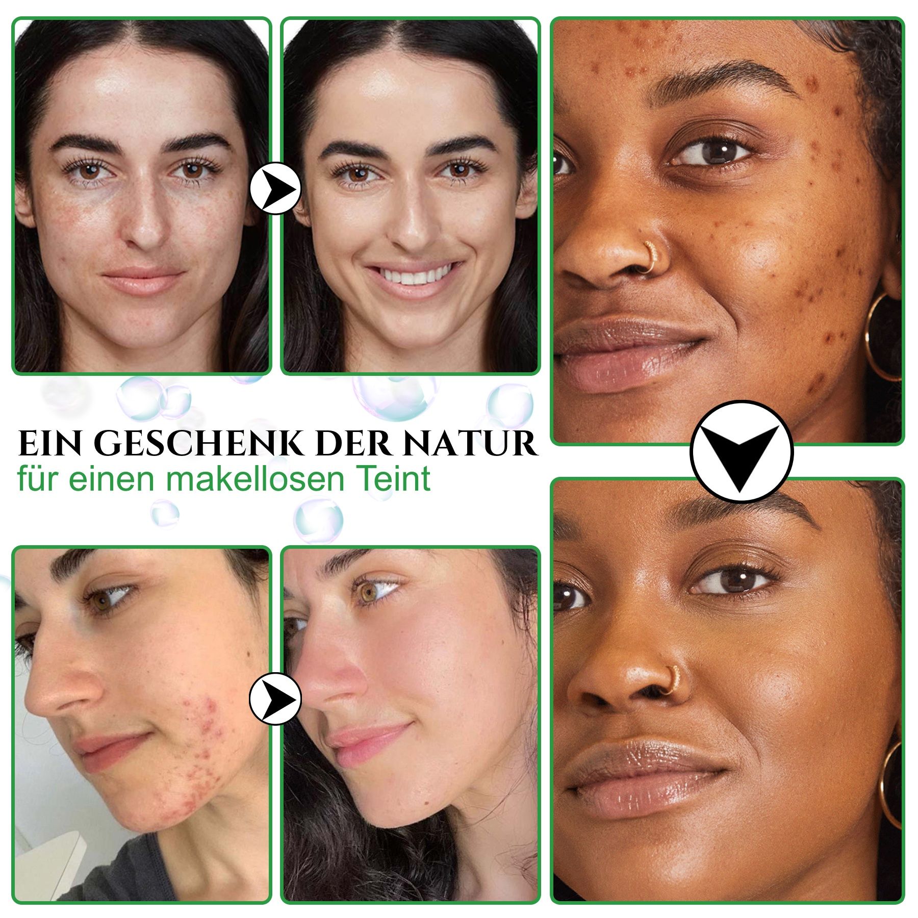 Vorher-Nachher-Bilder von Gesichtern. Text: Ein Geschenk der Natur für einen makellosen Teint.