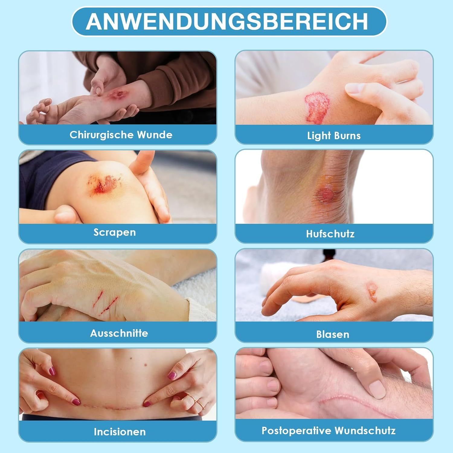 PimpleGuard Hydrocolloid Roll Blasenpflaster Wasserfest