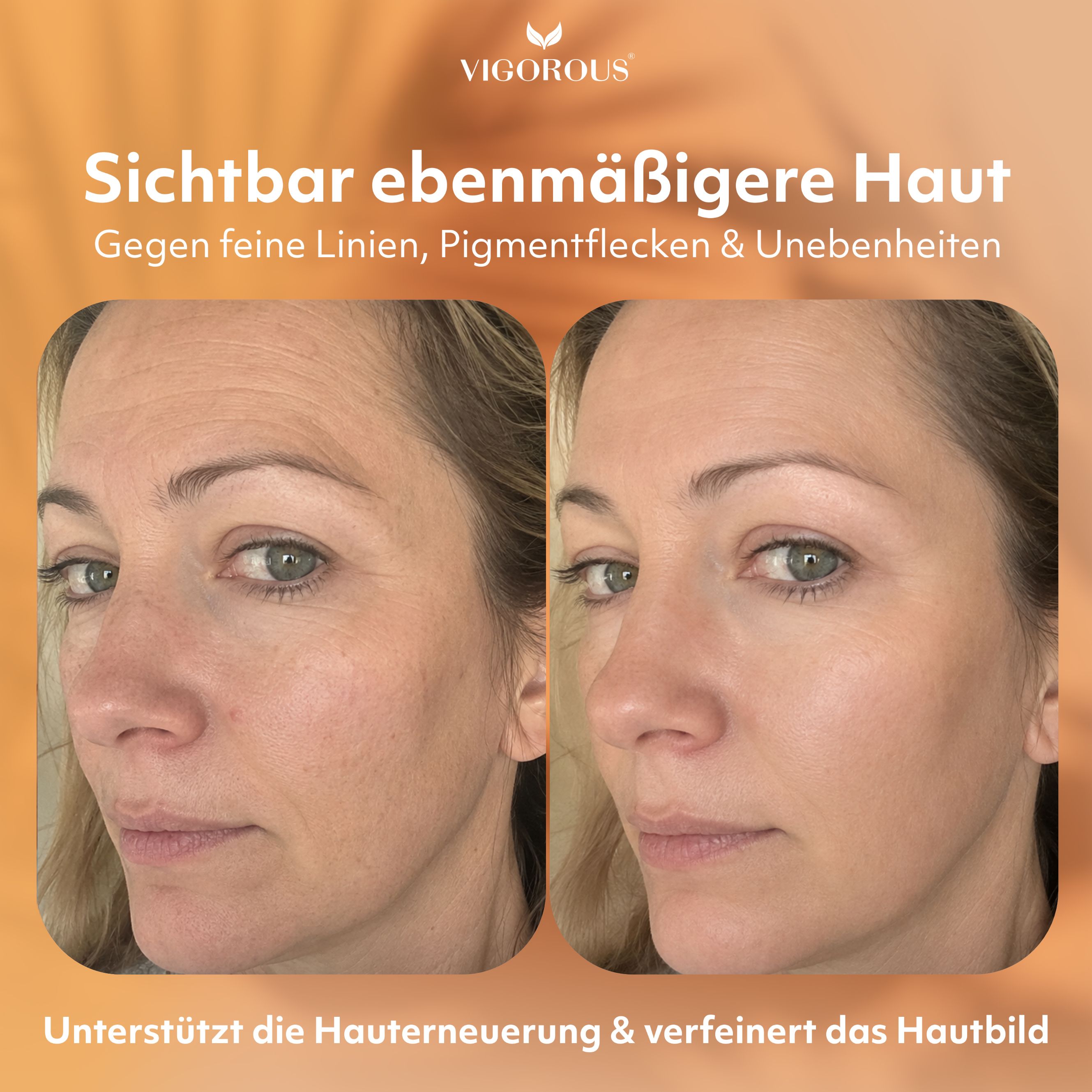 Vorher-Nachher-Vergleich: Haut einer Frau mit feinen Linien und Pigmentflecken, dann mit ebenmäßigerer Haut.