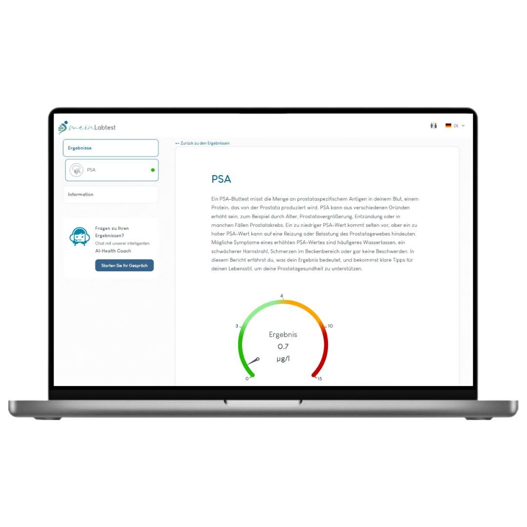 Laptop mit Testergebnissen. Auf dem Bildschirm: PSA-Informationen und Diagramm. Logo: meinLabtest.