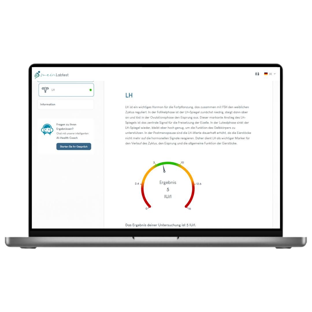Laptop mit LH-Testergebnissen. Anzeige: Diagramm, Ergebnis 5,0. meinLabtest-Logo.