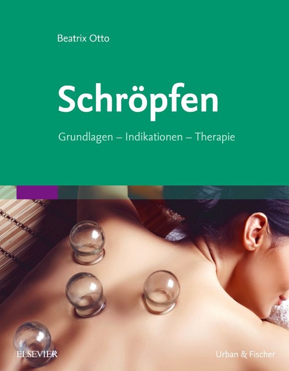 Buchcover: "Schröpfen" von Beatrix Otto. Titel und Untertitel auf grünem Hintergrund. Frau mit Schröpfgläsern auf dem Rücken.