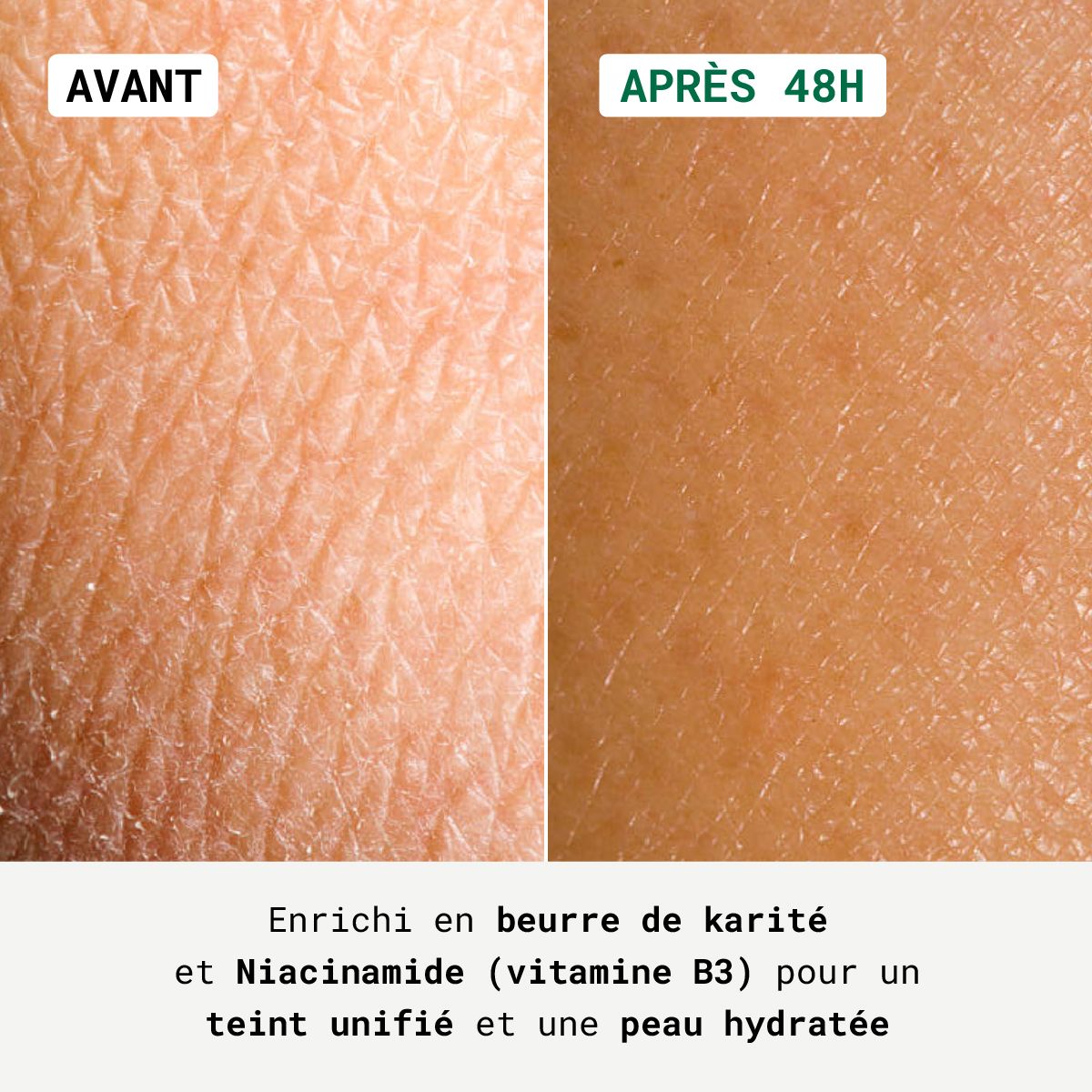 Haut vor und nach 48 Stunden. Text: Angereichert mit Sheabutter und Niacinamid für einen ebenmäßigen Teint.