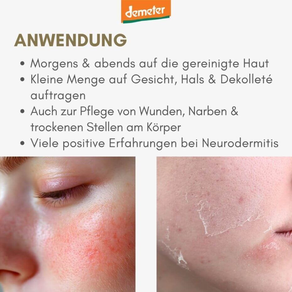 Anwendungshinweise. Zwei Hautbilder: gerötete Haut, Hautschuppung. Text: Morgens & abends auftragen, Neurodermitis.