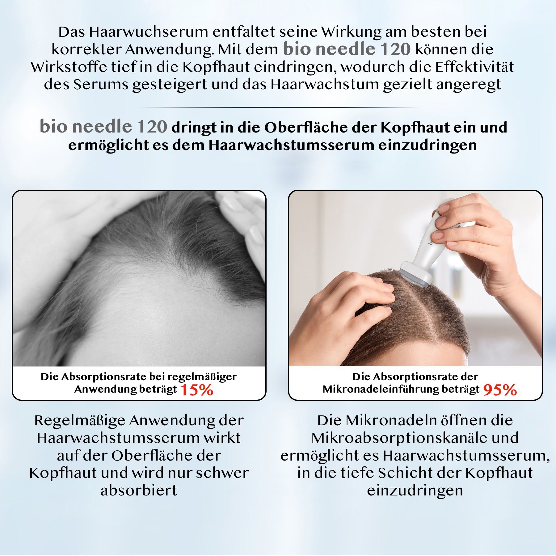 Confronto del trattamento della caduta dei capelli. Testo: bio needle 120. Assorbimento con uso regolare 15%. Micro-aghi 95%.