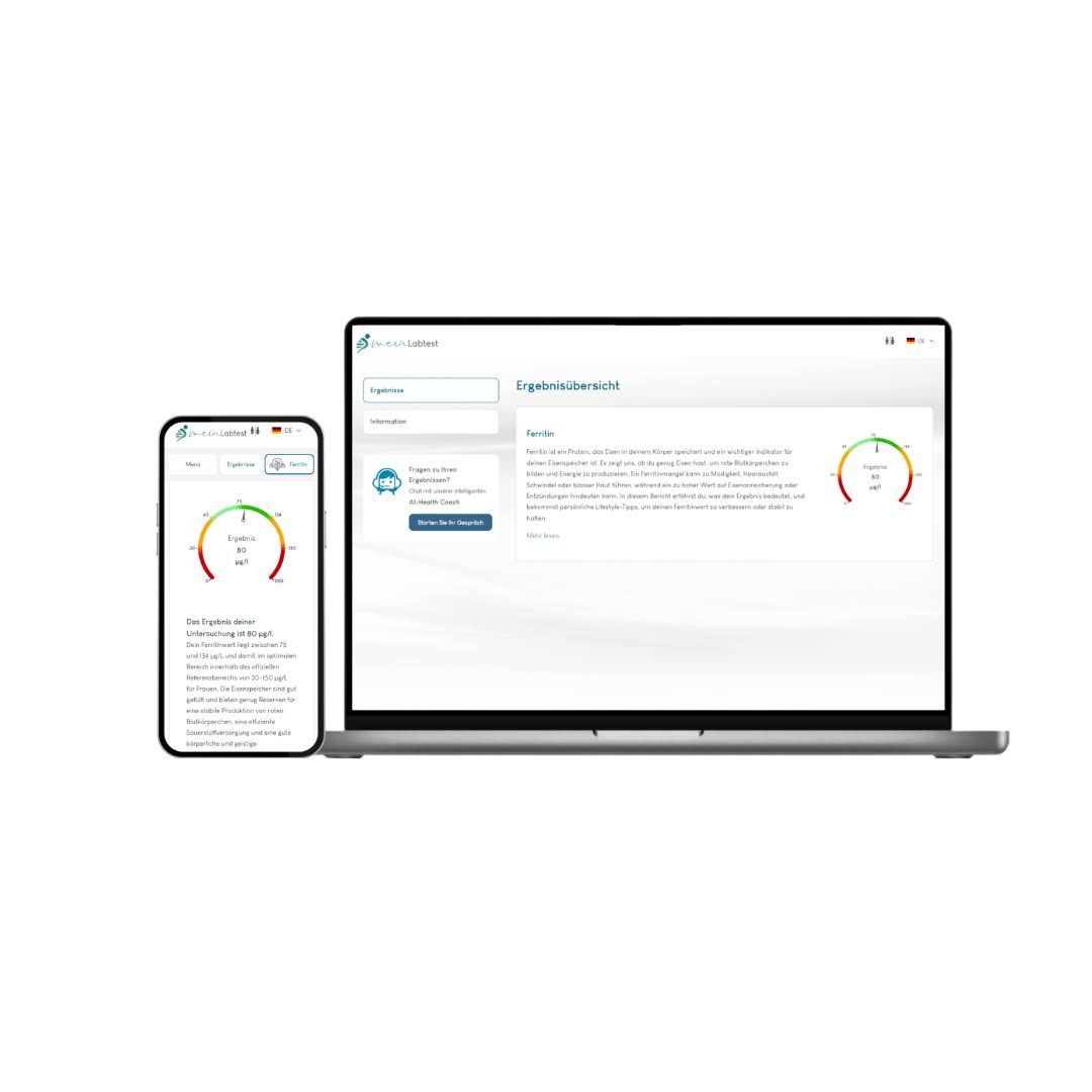 Laptop und Smartphone mit Ergebnisübersicht. Anzeige von Testergebnissen. Logo von meinLabtest.de.