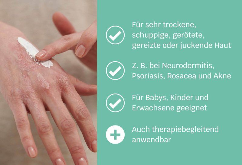 SIRIDERMA AKUT Intensivmaske ohne Duft