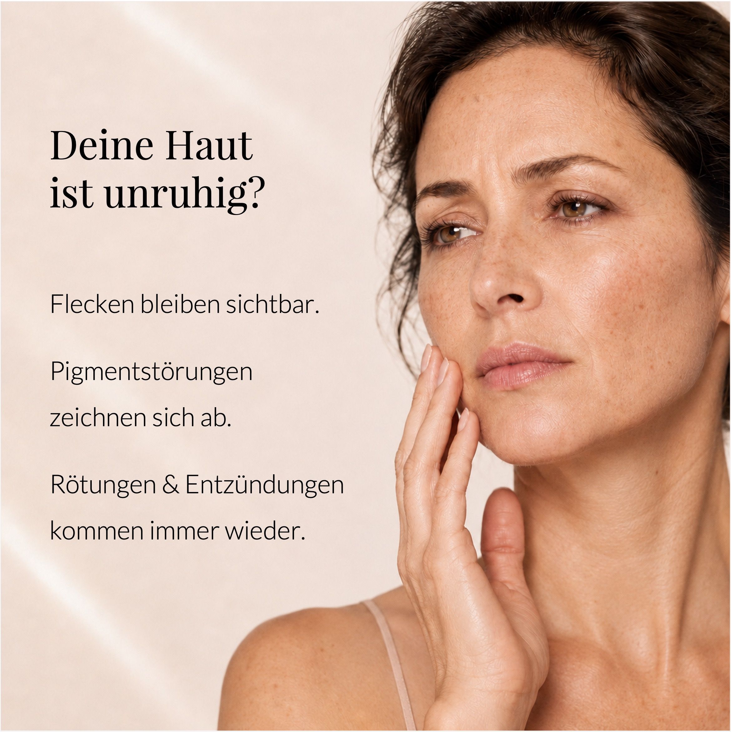 Frau mit Pigmentflecken, Text: Unruhige Haut, Pigmentstörungen, Rötungen