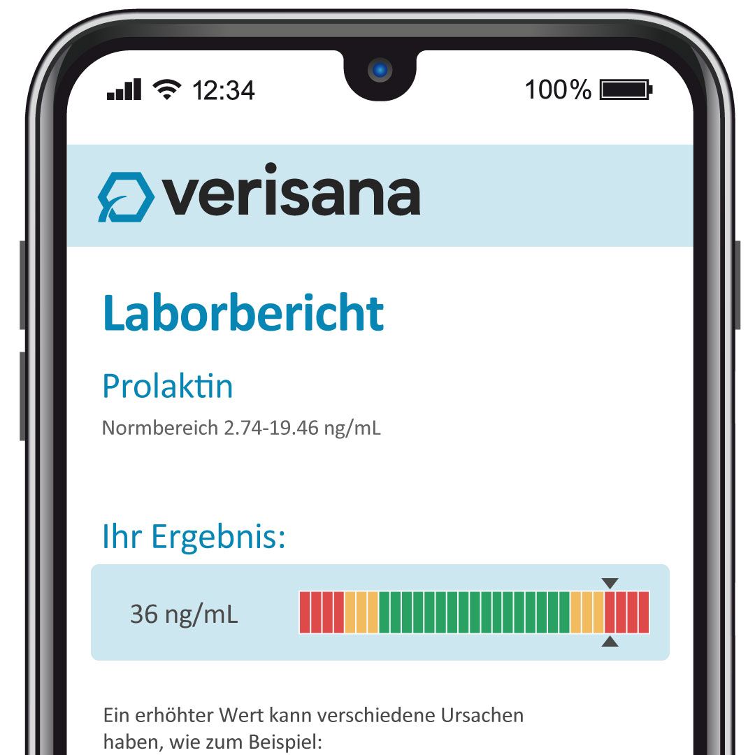 Verisana Prolaktin Test für Frauen
