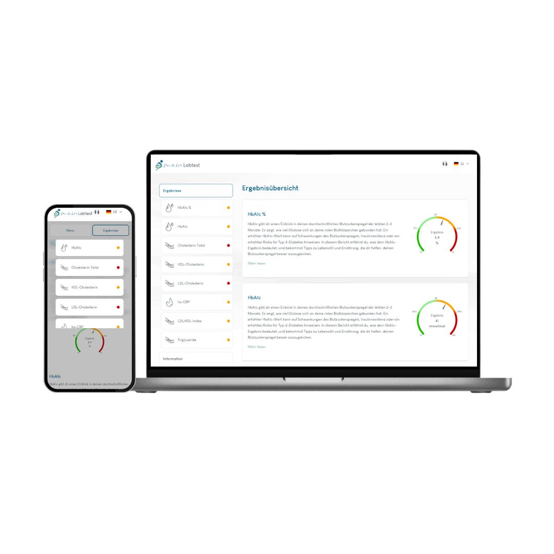 Laptop und Smartphone mit Testergebnissen. Auf dem Bildschirm: Ergebnisse, Diagramme und Text. Logo: meinLabtest.