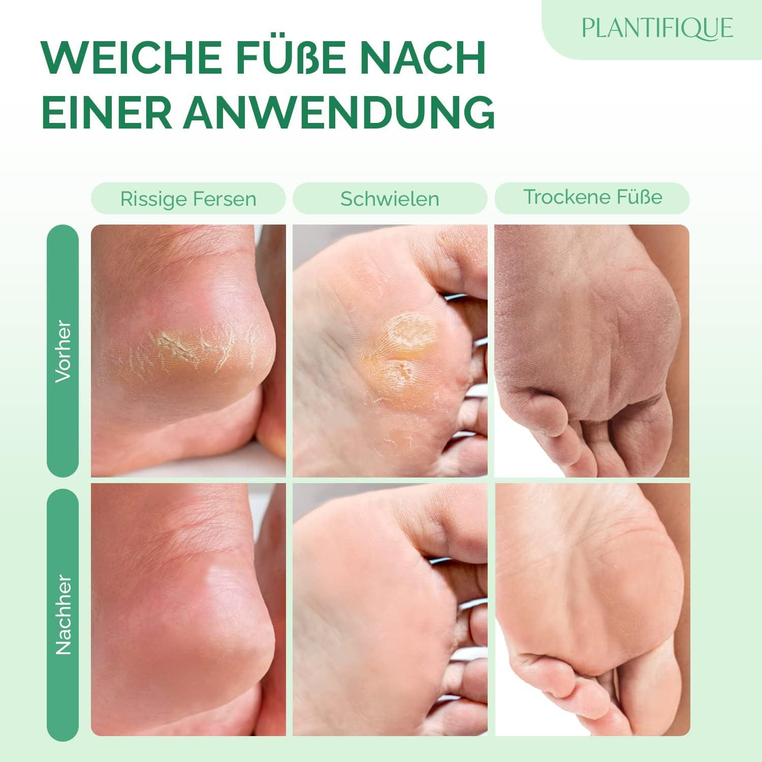 Fußmaske - Hornhaut Socken - Fussmaske Vitamine 2 Paar Hornhautentferner Socken