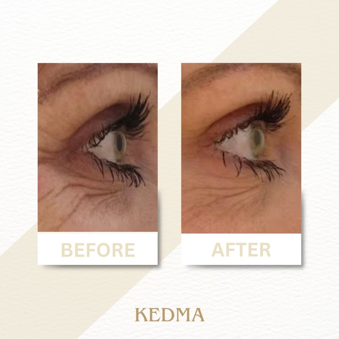 Kedma - Anti-Aging Augencreme mit Kollagen
