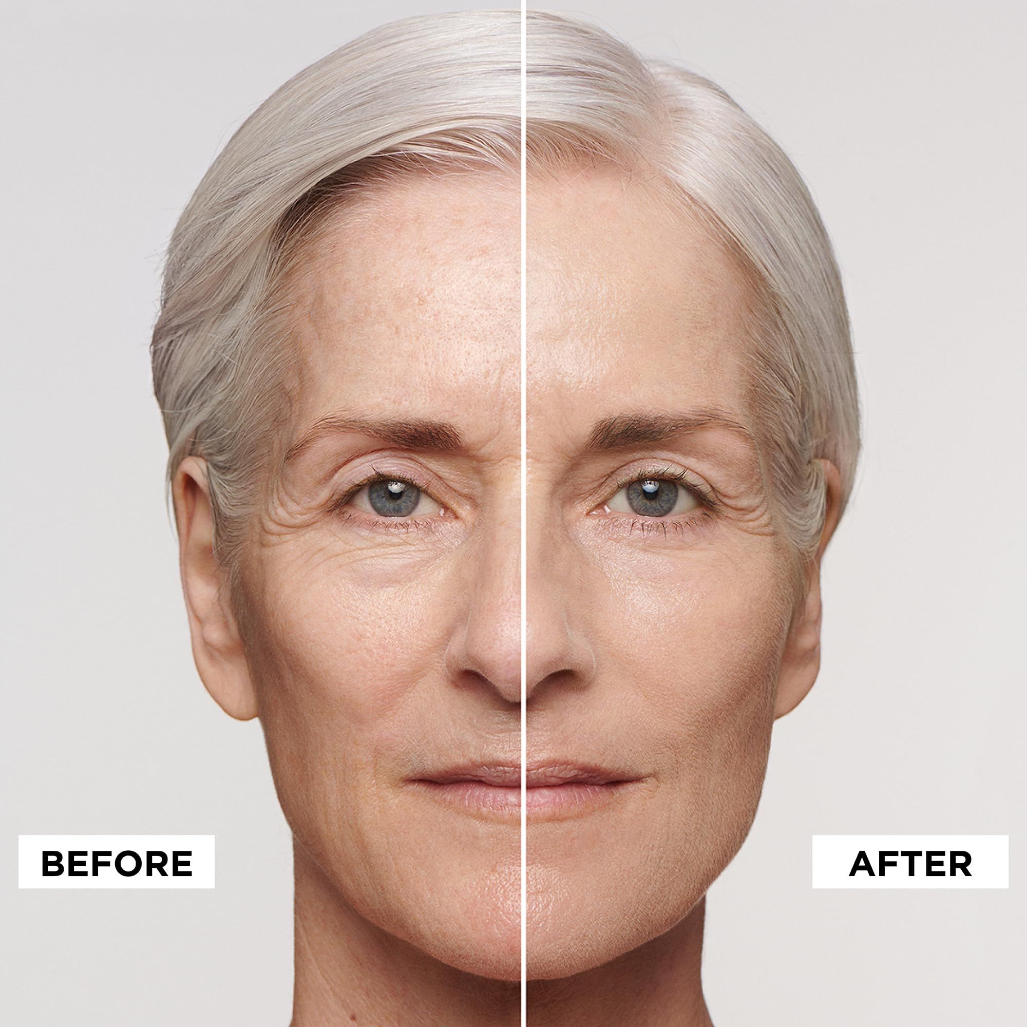 Gesicht, geteilt in Vorher-Nachher. Linke Gesichtshälfte: vor Anwendung. Rechte Gesichtshälfte: nach Anwendung. Text: BEFORE, AFTER.
