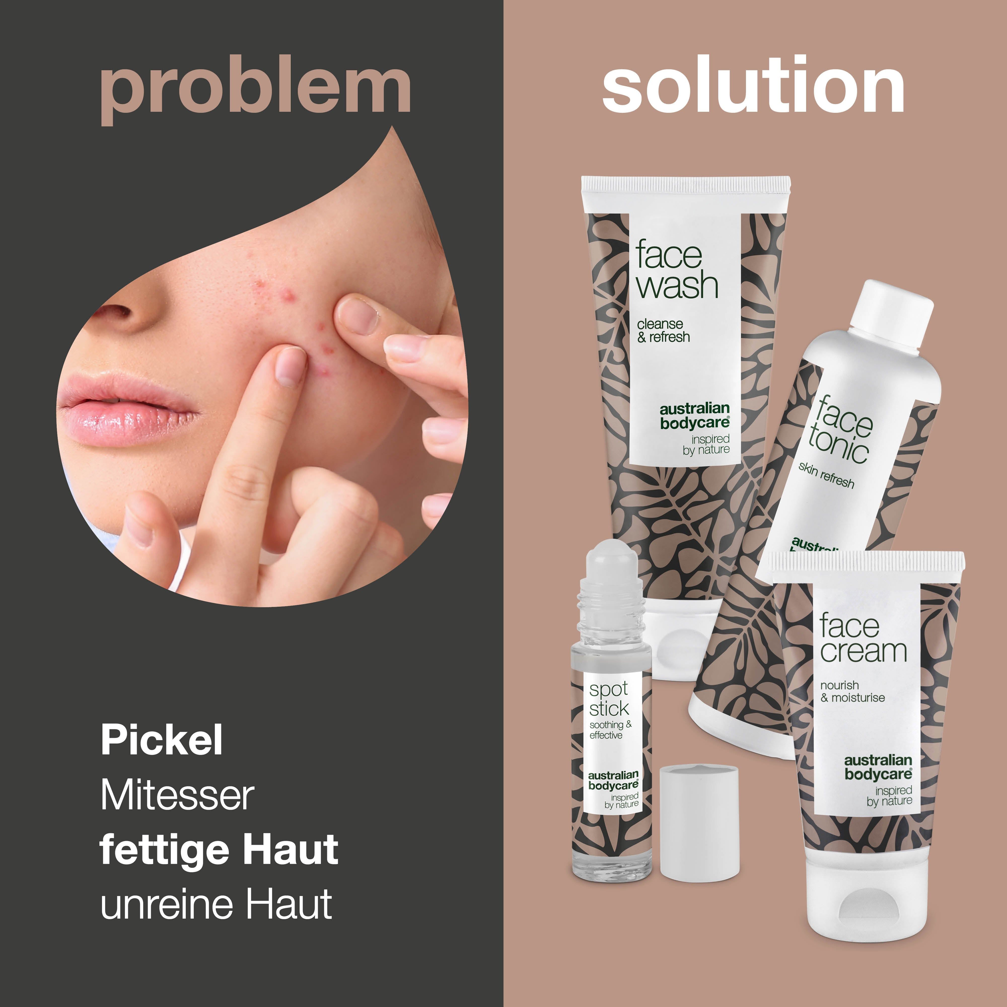 Gesicht mit Pickeln. Daneben vier Produkte: Face Wash, Face Tonic, Face Cream und Spot Stick. Text: Pickel, fettige Haut.