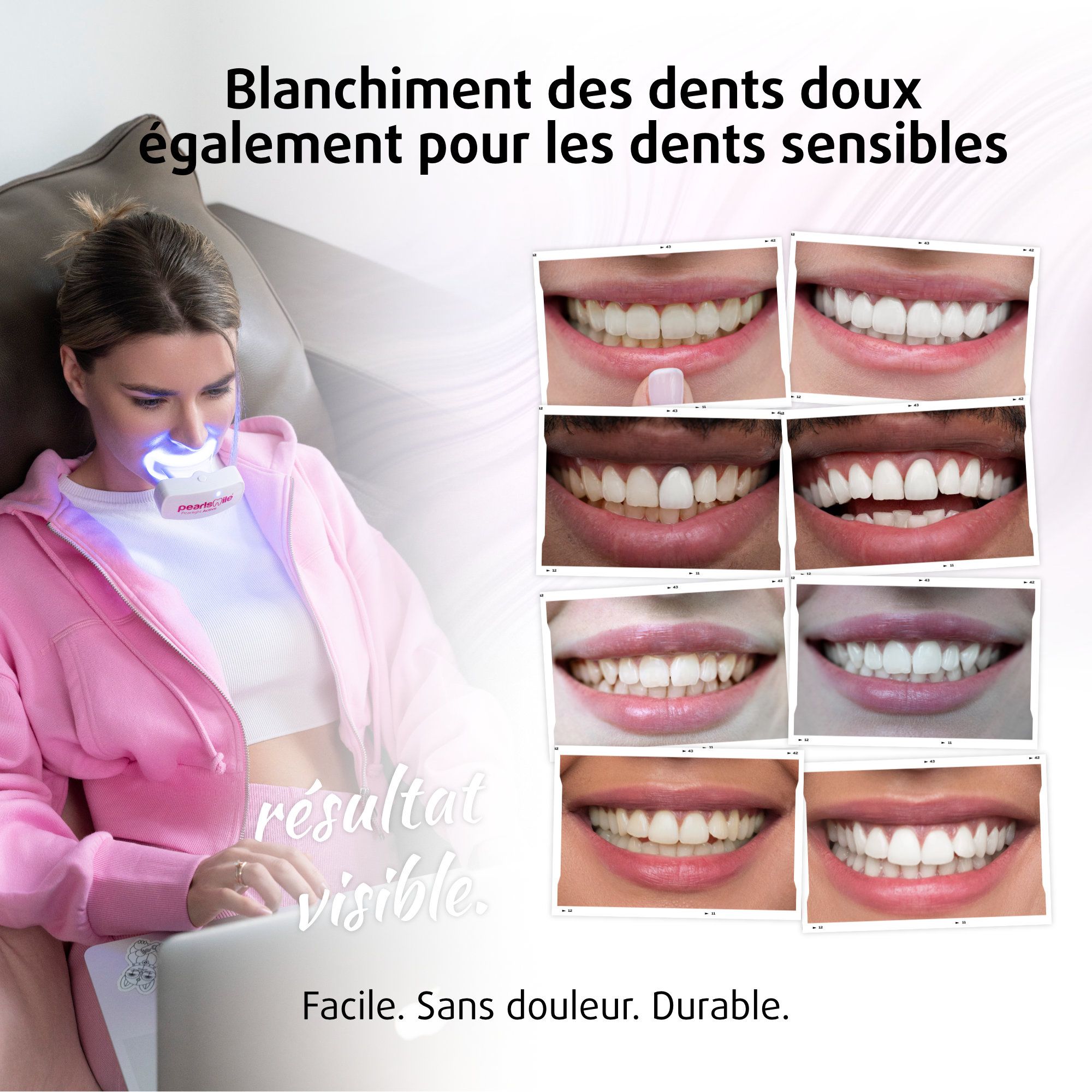 Femme avec gouttière. Plusieurs photos montrent des dents blanches. Texte: Résultat visible. Facile. Sans douleur. Durable.