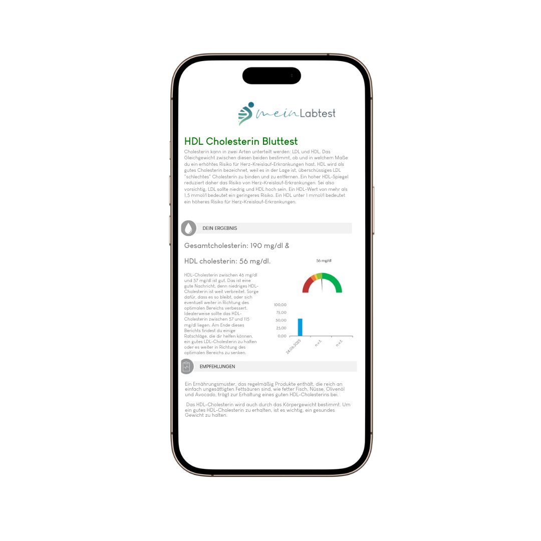 Smartphone mit HDL Cholesterin Bluttest-Ergebnissen. Diagramme und Text.