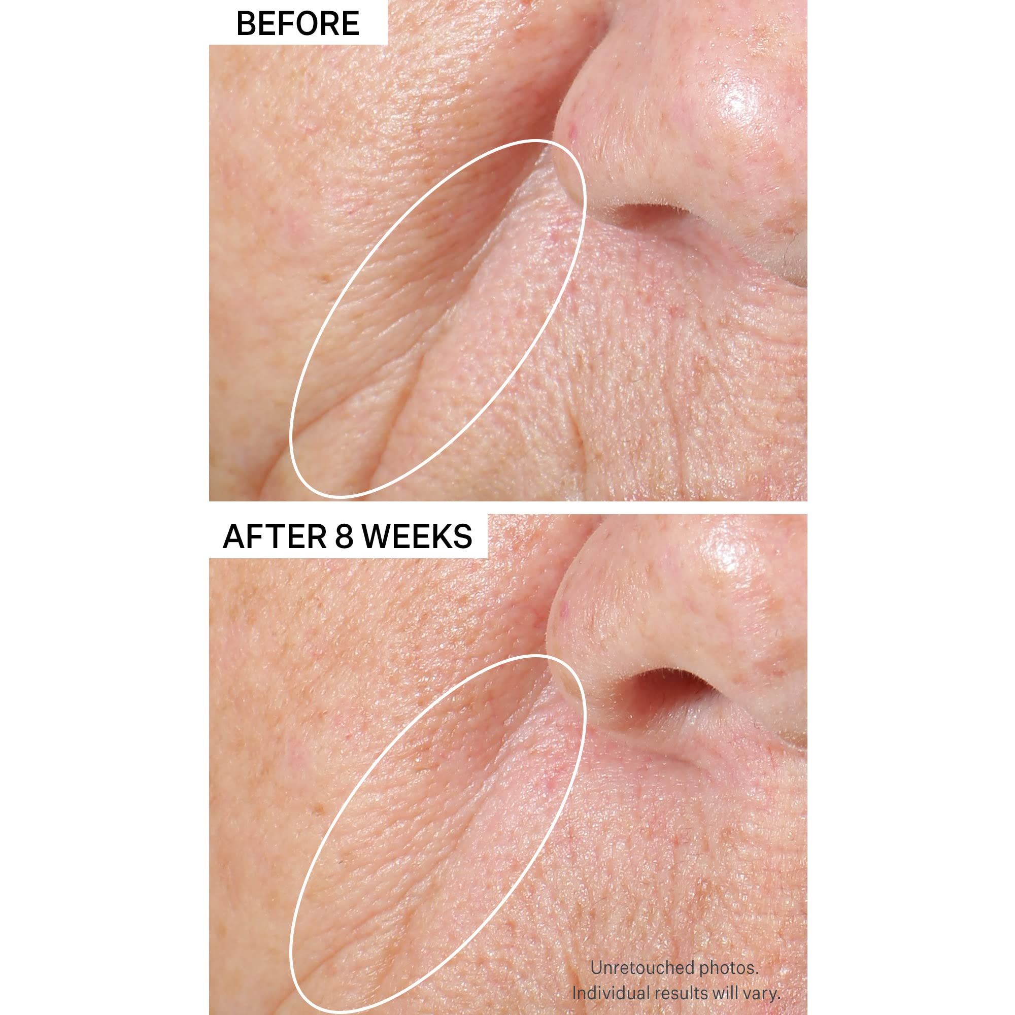 ANTI-FALTEN-Peptid-Plump-Serum 30 ml