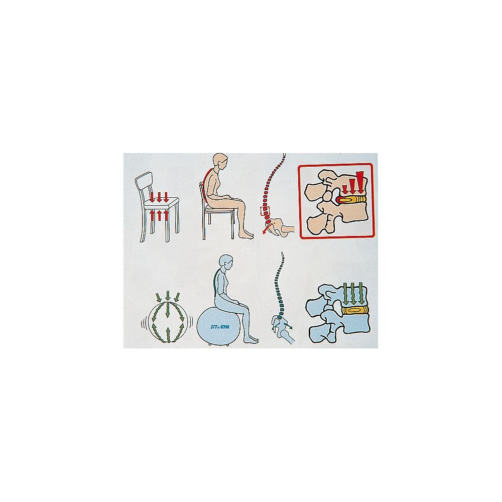 Illustrationen zur Wirbelsäule und Sitzpositionen. Vergleich zwischen Stuhl und Gymnastikball. Anatomische Darstellung.