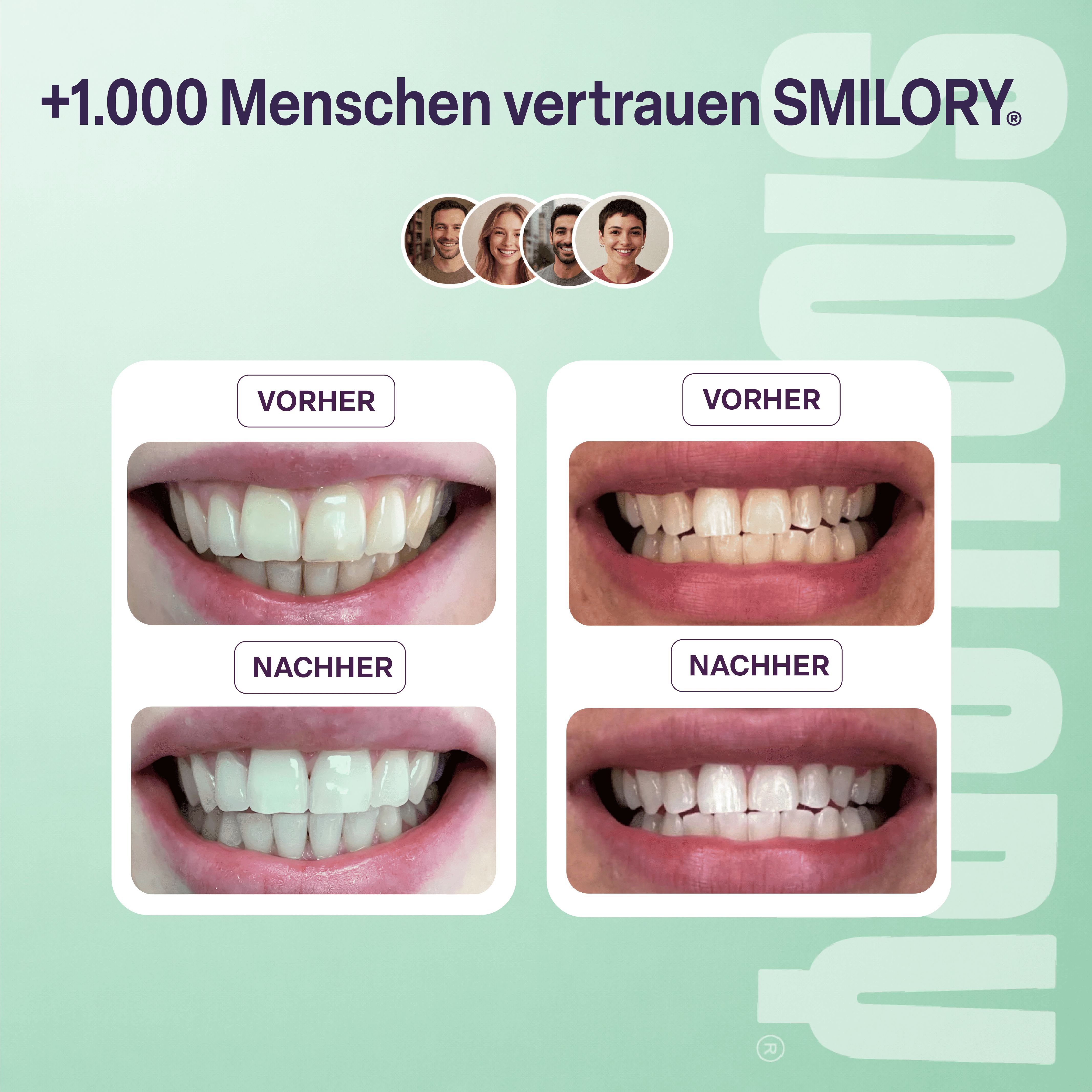 Smilory® Smile Strips - Zahnaufhellungsstreifen (Minze)