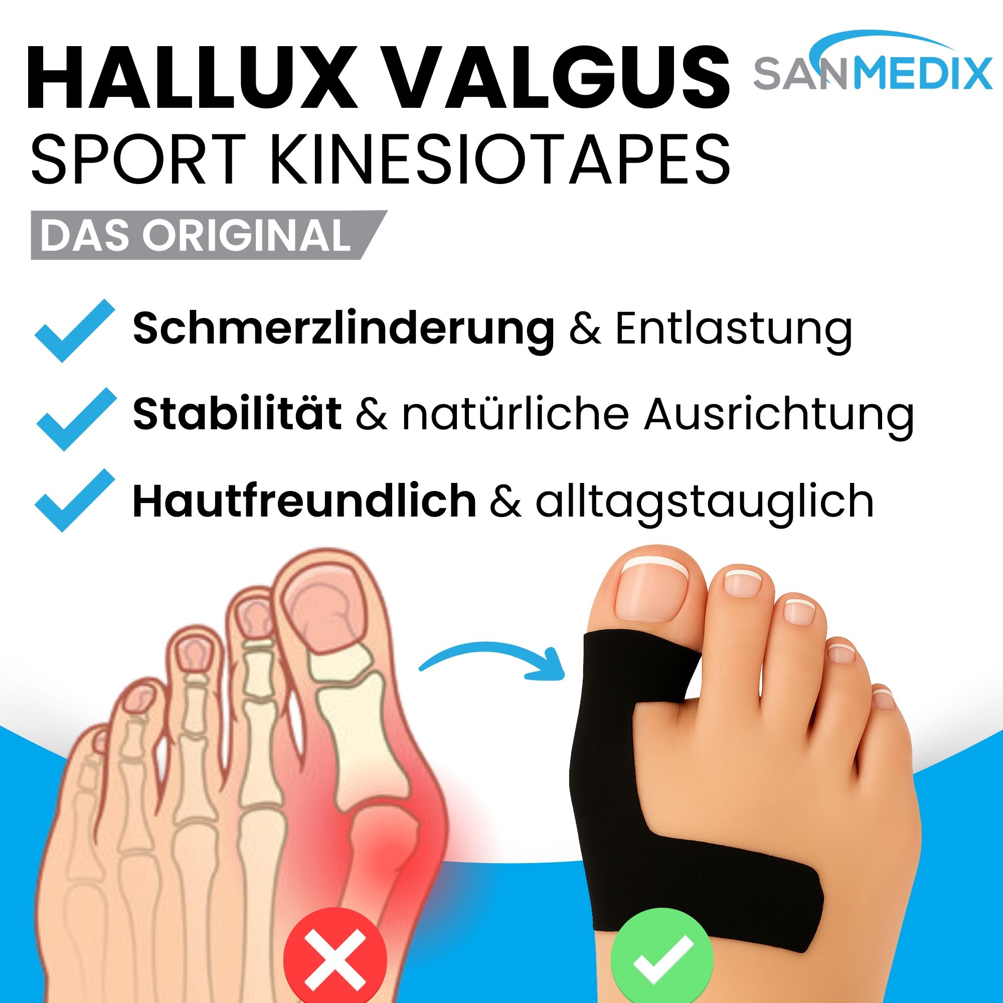 Sanmedix® Hallux Valgus Kinesiologie Tapes - Kinesiotape Vorgeschnitten