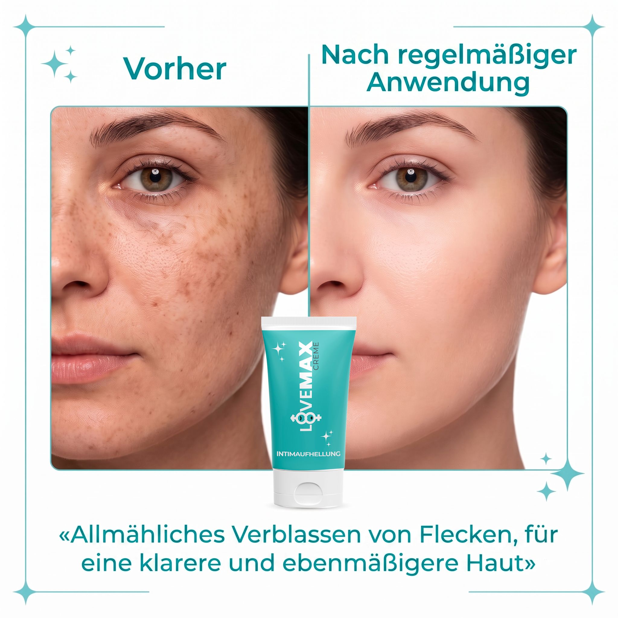 Vorher-Nachher-Vergleich von Hautflecken und eine Tube LOVE MAX Hautaufhellung.