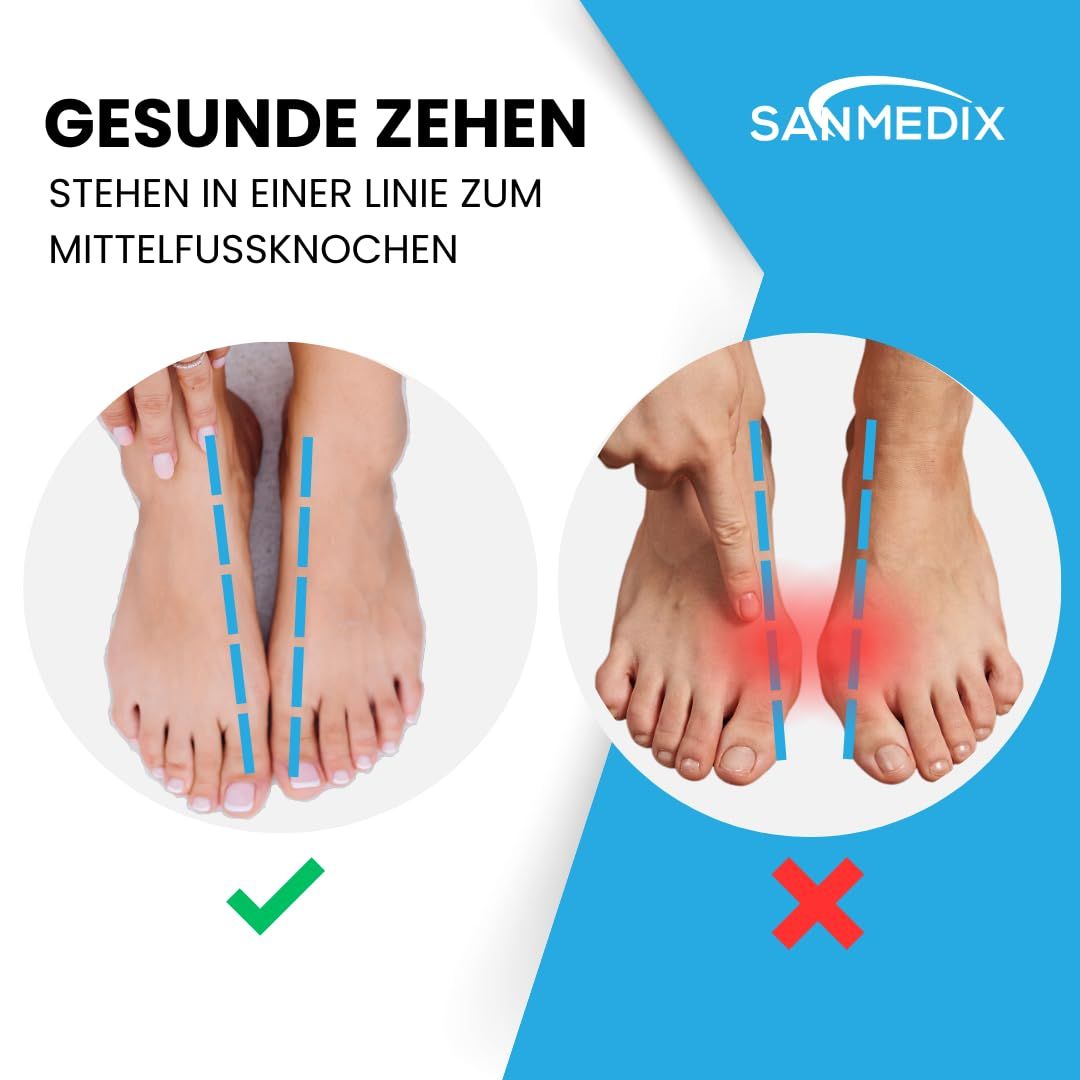 Sanmedix® Zehenspreizer