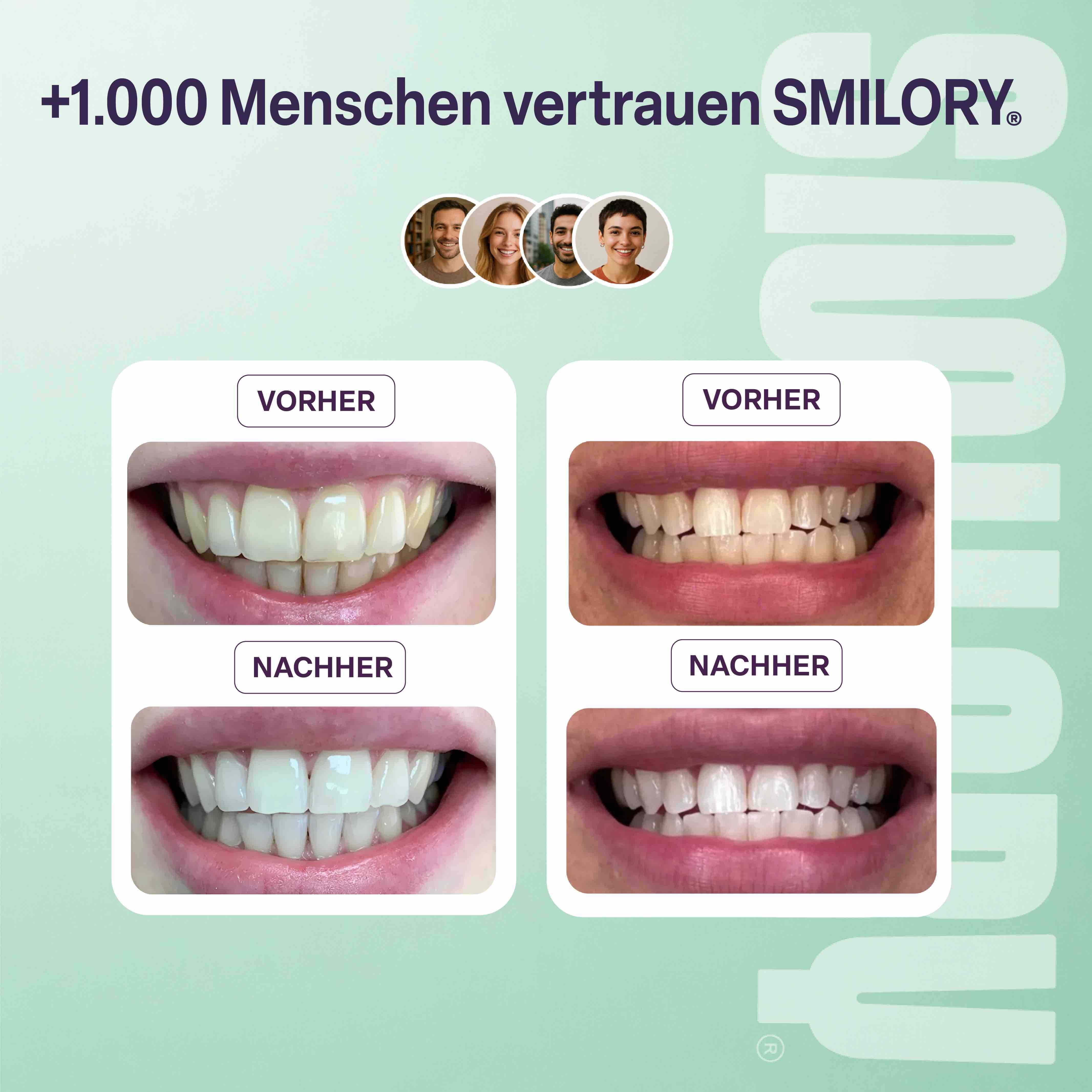 Vorher-Nachher-Vergleich von Zähnen. Vier Paare von Bildern. Oben: gelbliche Zähne. Unten: weiße Zähne. Text: „+1.000 Menschen vertrauen SMILORY“.