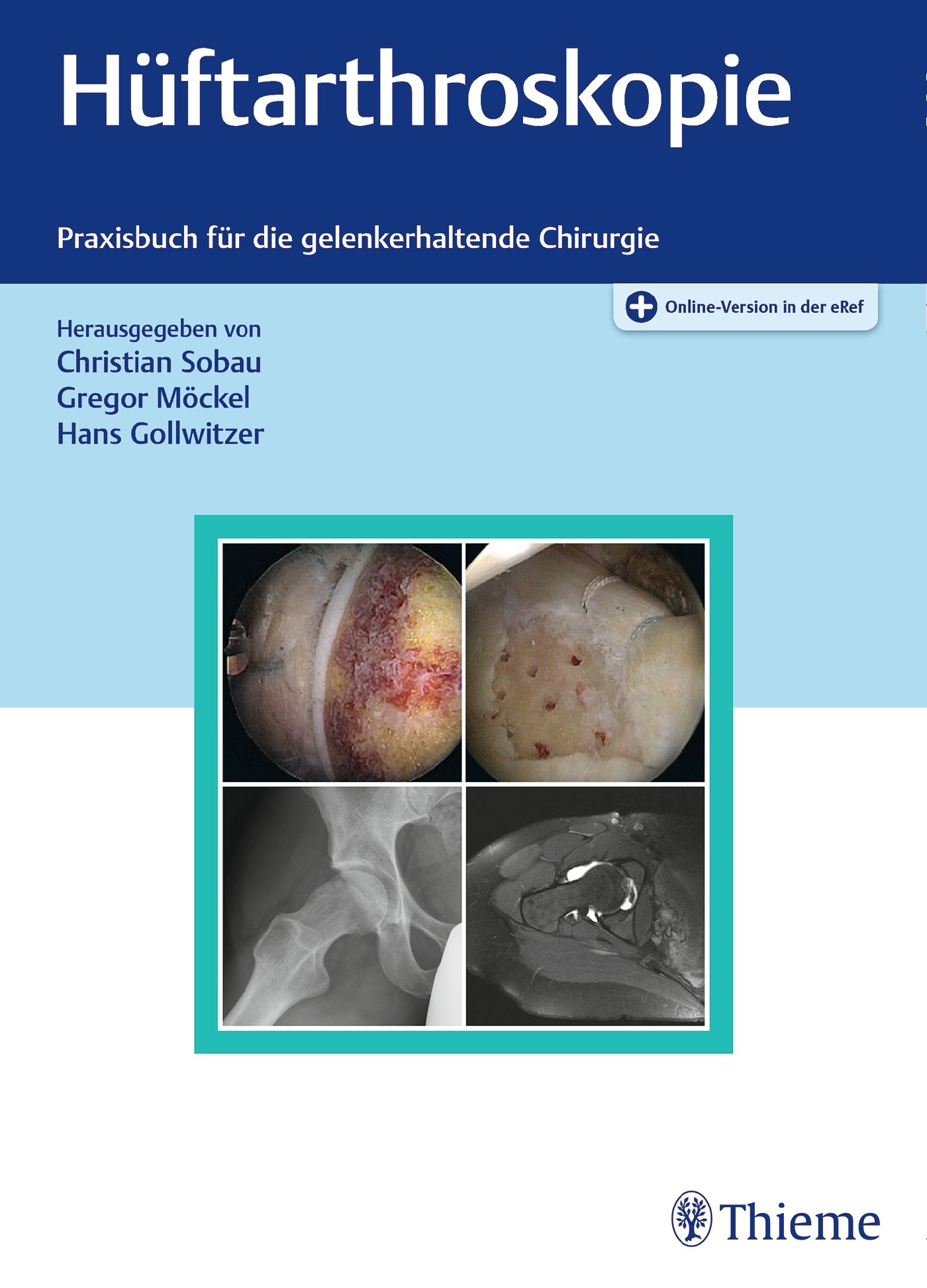 Buchcover mit Titel "Hüftarthroskopie". Untertitel: Praxisbuch für die gelenkerhaltende Chirurgie. Herausgeber: Sobau, Möckel, Gollwitzer. Verlag Thieme.