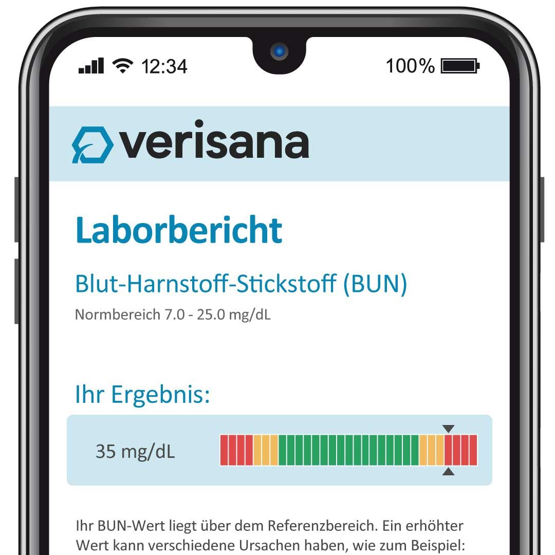 Smartphone mit Verisana-App. Anzeige Laborbericht mit BUN-Wert. Balkendiagramm zeigt Ergebnis. Text: Laborbericht, BUN, Ergebnis.