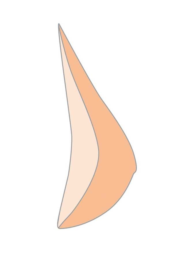Brustprothese in Tropfenform. Zweifarbig: hell und dunkel. Asymmetrische Form.