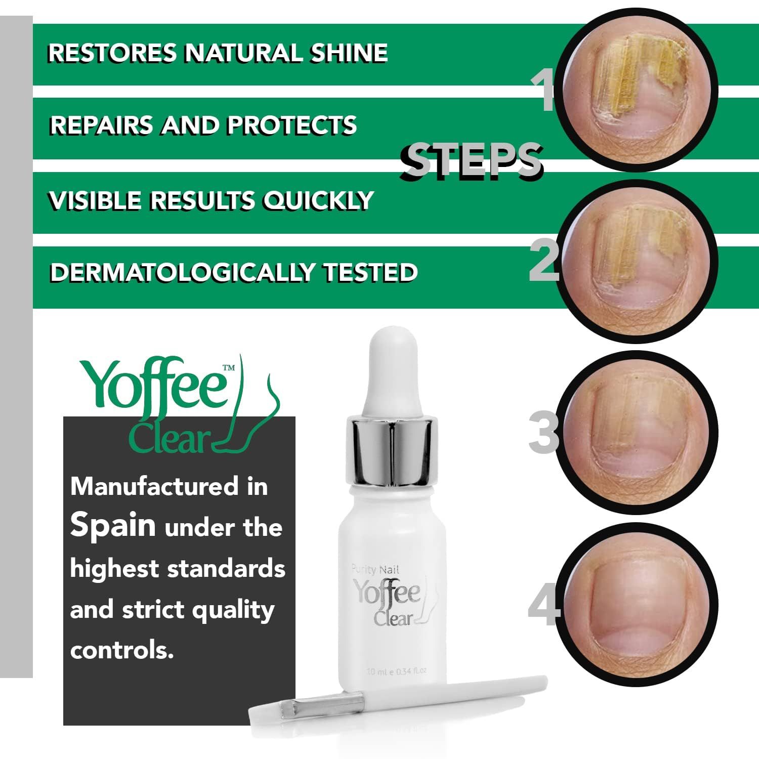 Yoffee Clear Nail Care Anti Nagelpilz Behandlung - Nagellack 10 ml - Antimykotische, Antibakterielle