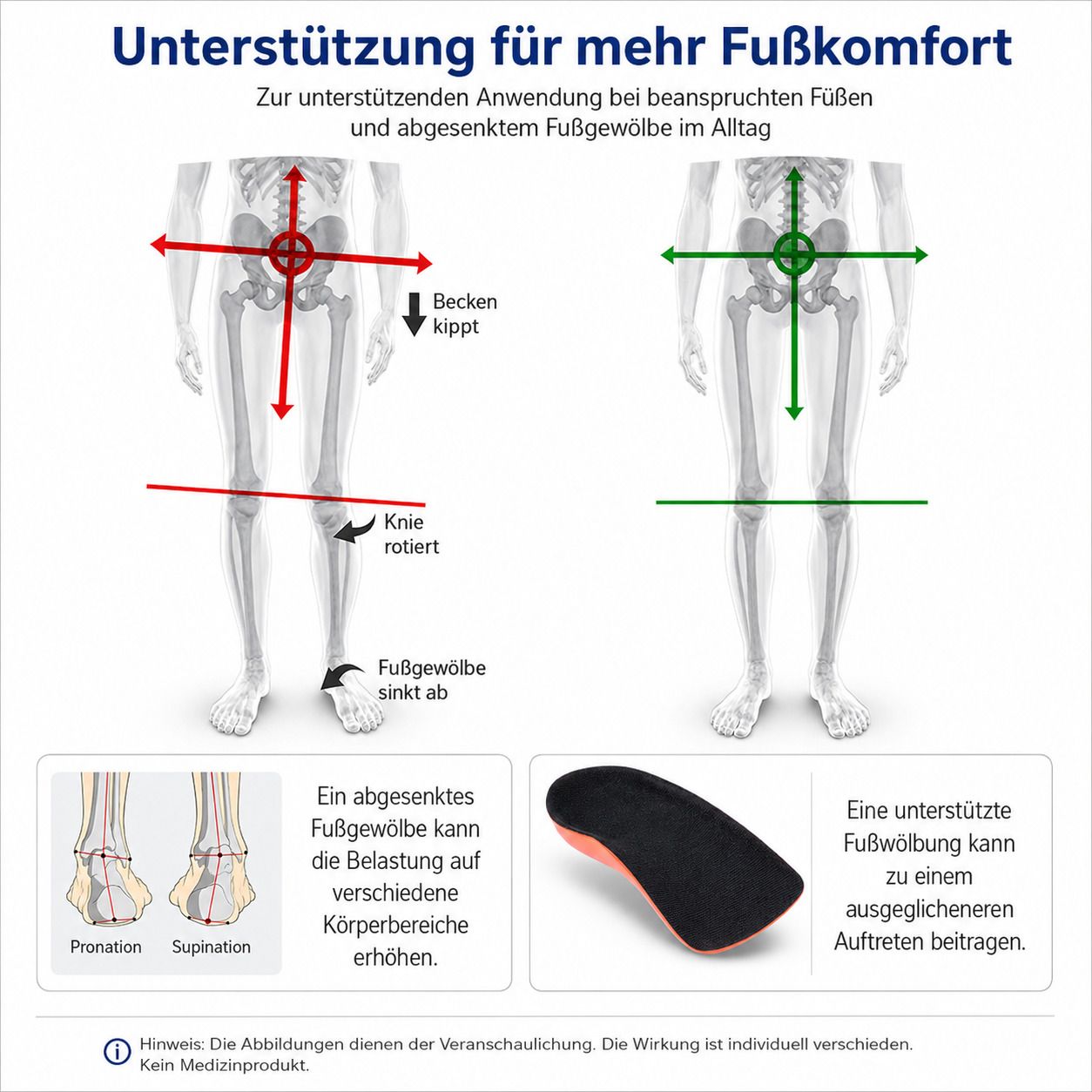 Fußkomfort durch Unterstützung des Fußgewölbes, zeigt Beckenkipp, Knie- und Fußrotation.