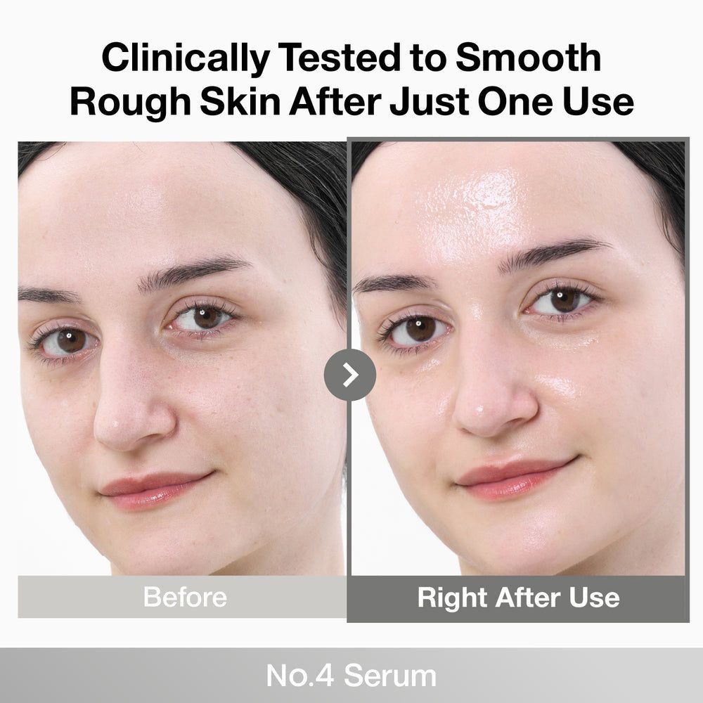 Vorher/Nachher-Hautbild: Vergleich "Before" und "Right After Use" mit Numbuzin Nr.4 Serum.