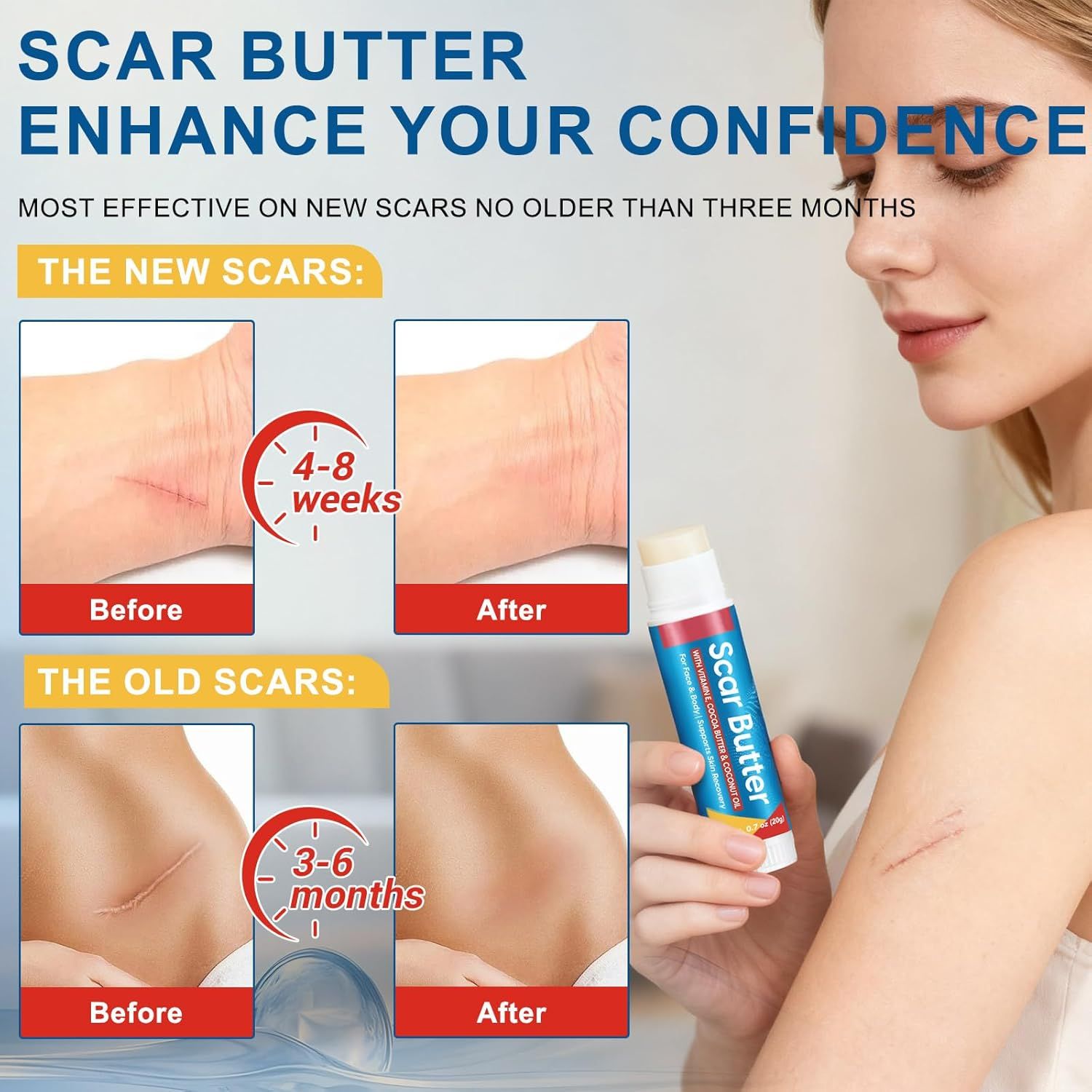 Frau mit "Scar Butter"-Stick. Vorher-Nachher-Bilder von Narben. Zeitangaben für neue und alte Narben.