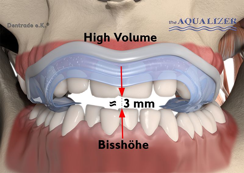 Aqualizer Slim High / Bisshöhe 3 mm