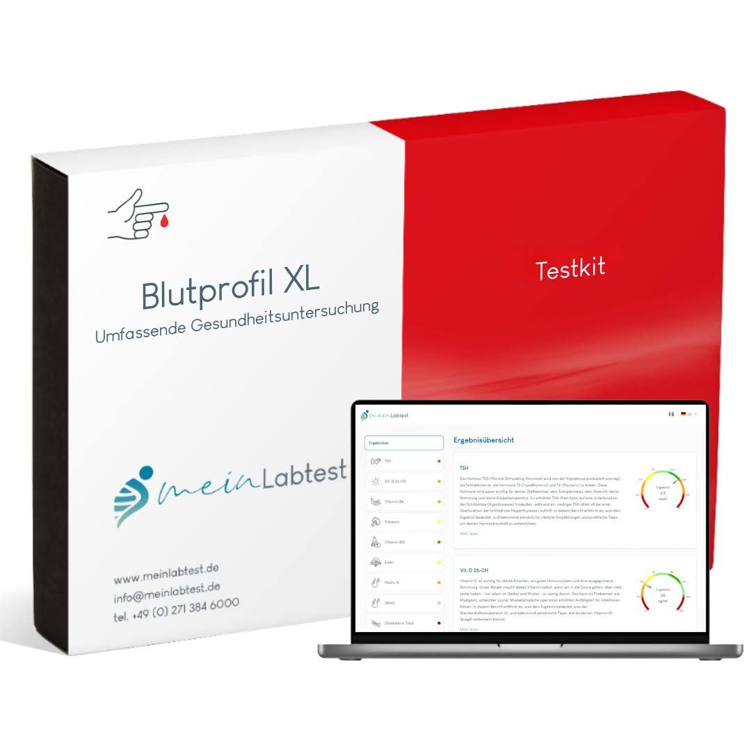Blutprofil XL Testkit-Verpackung und Laptop. Laptop zeigt Testergebnisse. Meinlabtest-Logo.