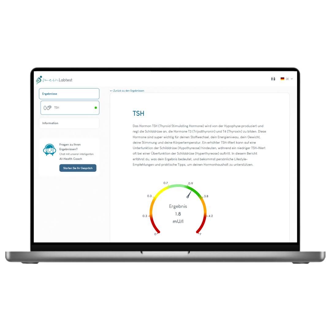 Laptop mit Testergebnissen. Diagramm und Text. Aufschrift: Ergebnisse, TSH. Informationen zur Schilddrüse. Logo von meinLabtest.