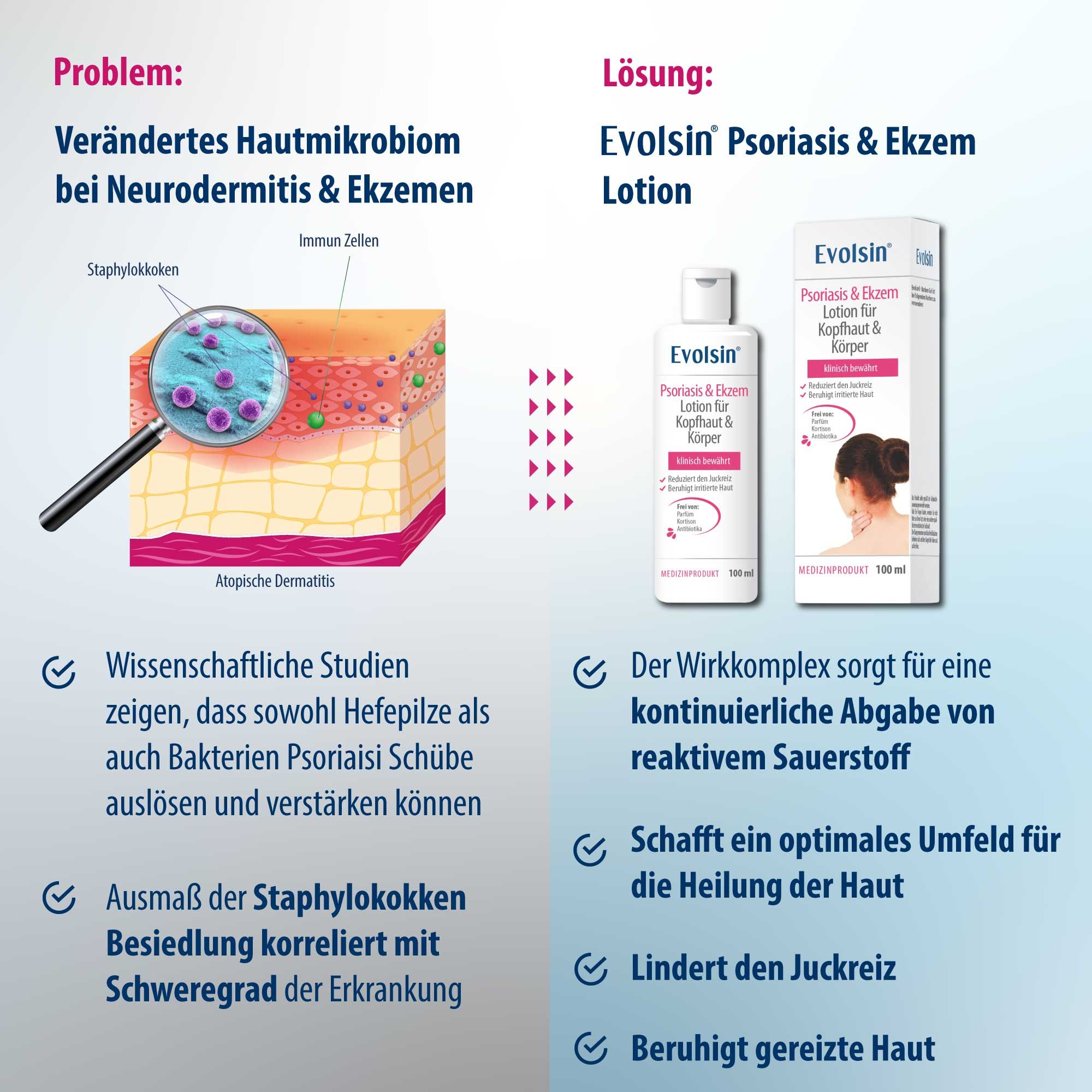 Evolsin Ekzem & Psoriasis Lotion für Kopfhaut und Körper