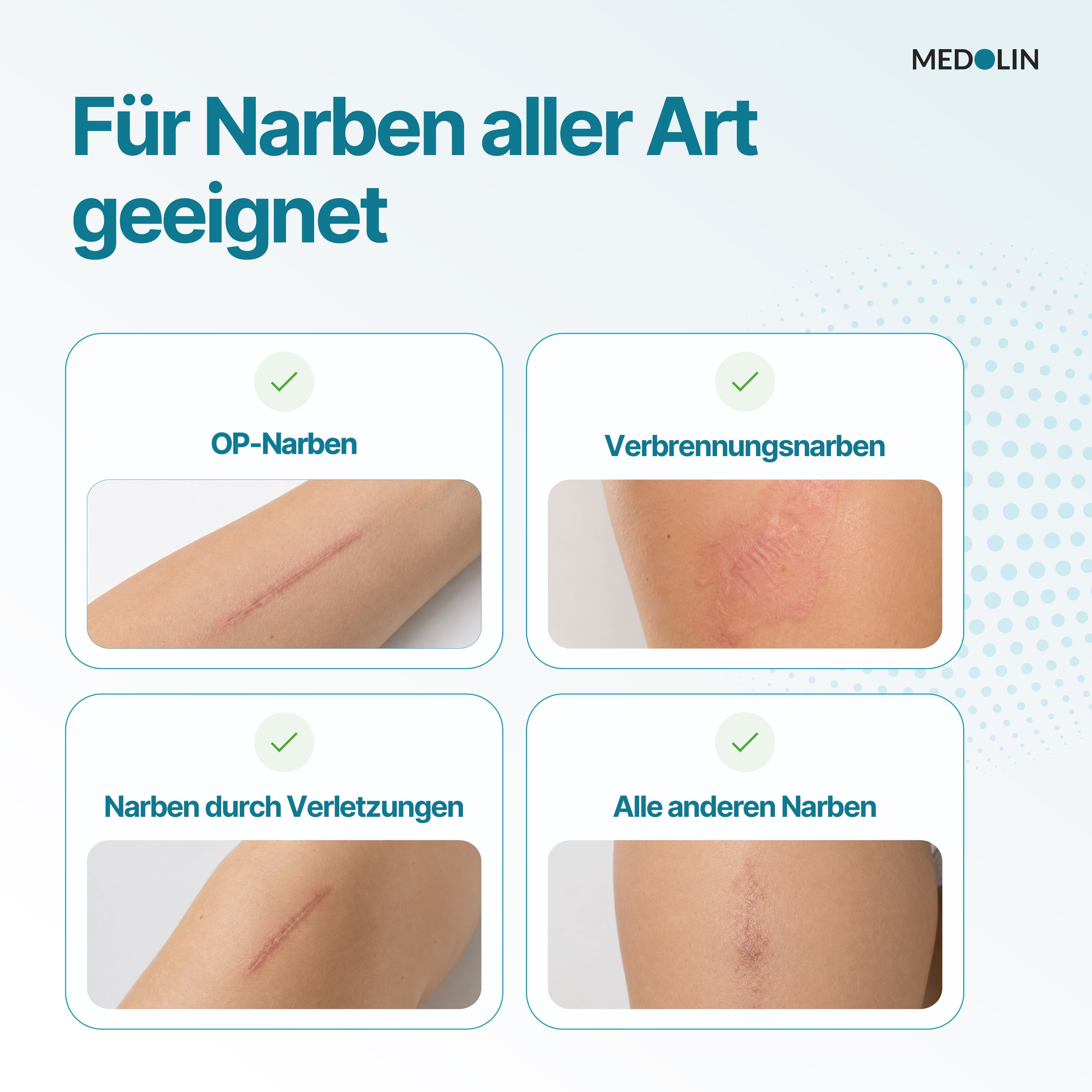 Medolin® Narbenpflaster