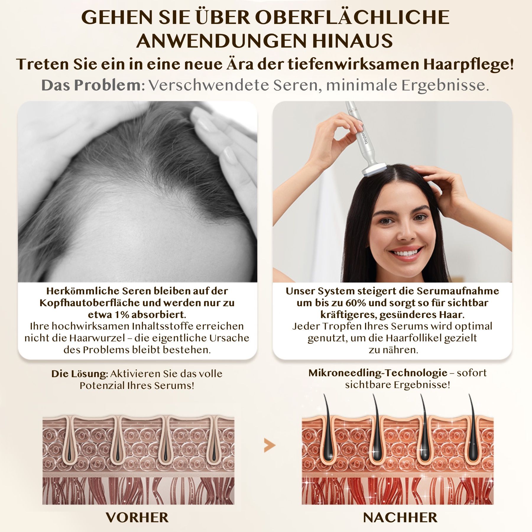 Vergleich Vorher/Nachher. Frau mit Haarausfall. Mikroneedling-Technologie. Dichteres Haar. Verbesserte Serumaufnahme.