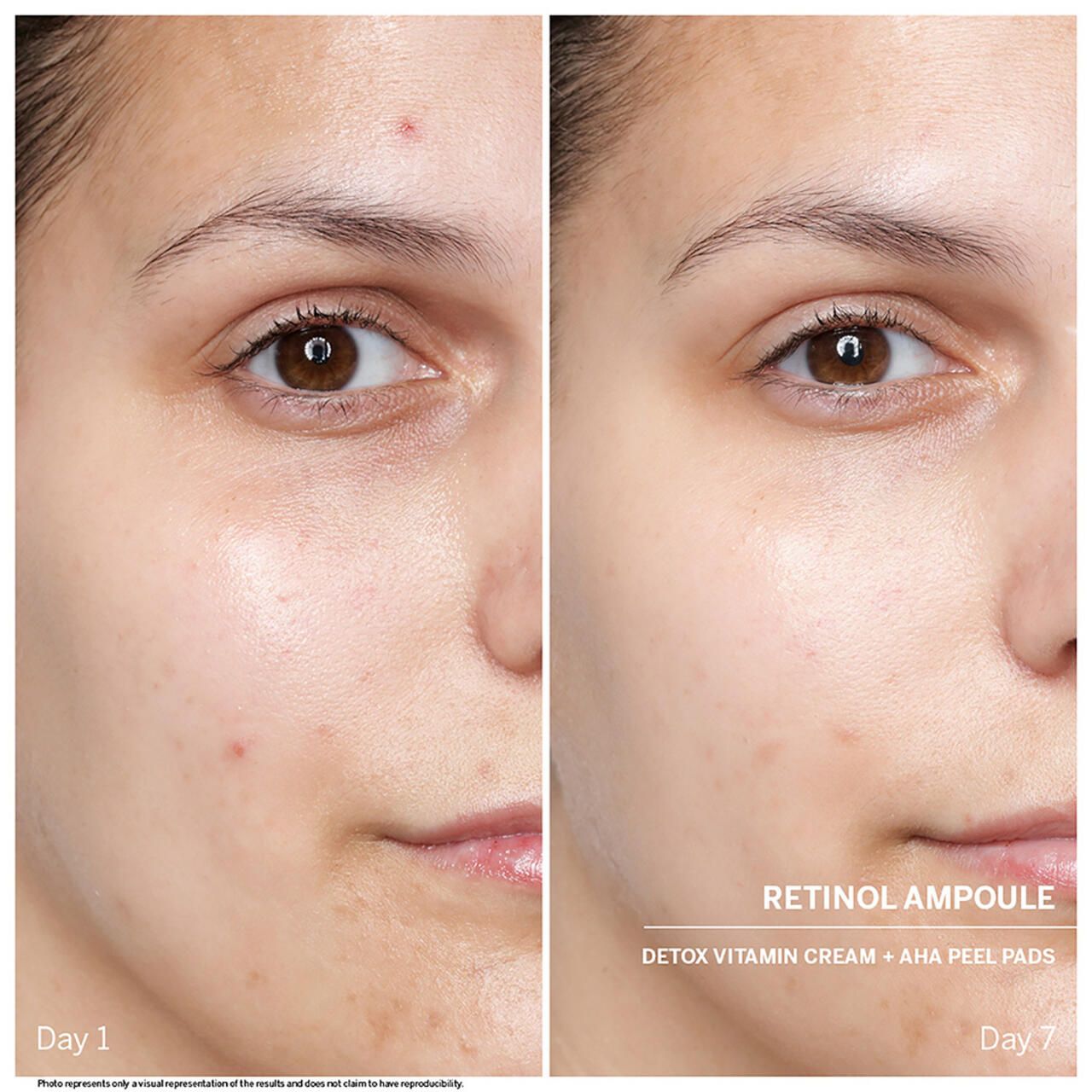 Vorher-Nachher-Bild. Gesichtshälften zeigen Hautzustand vor und nach Anwendung von Retinol Ampullen. Beschriftung mit 'Day 1' und 'Day 7'.