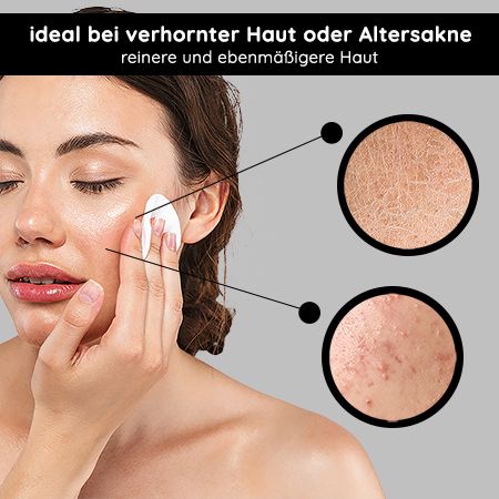 RAU Cosmetics Fruchtsäure Gesichtswasser AHA Tonic - Toner gegen Unreinheiten und große Poren
