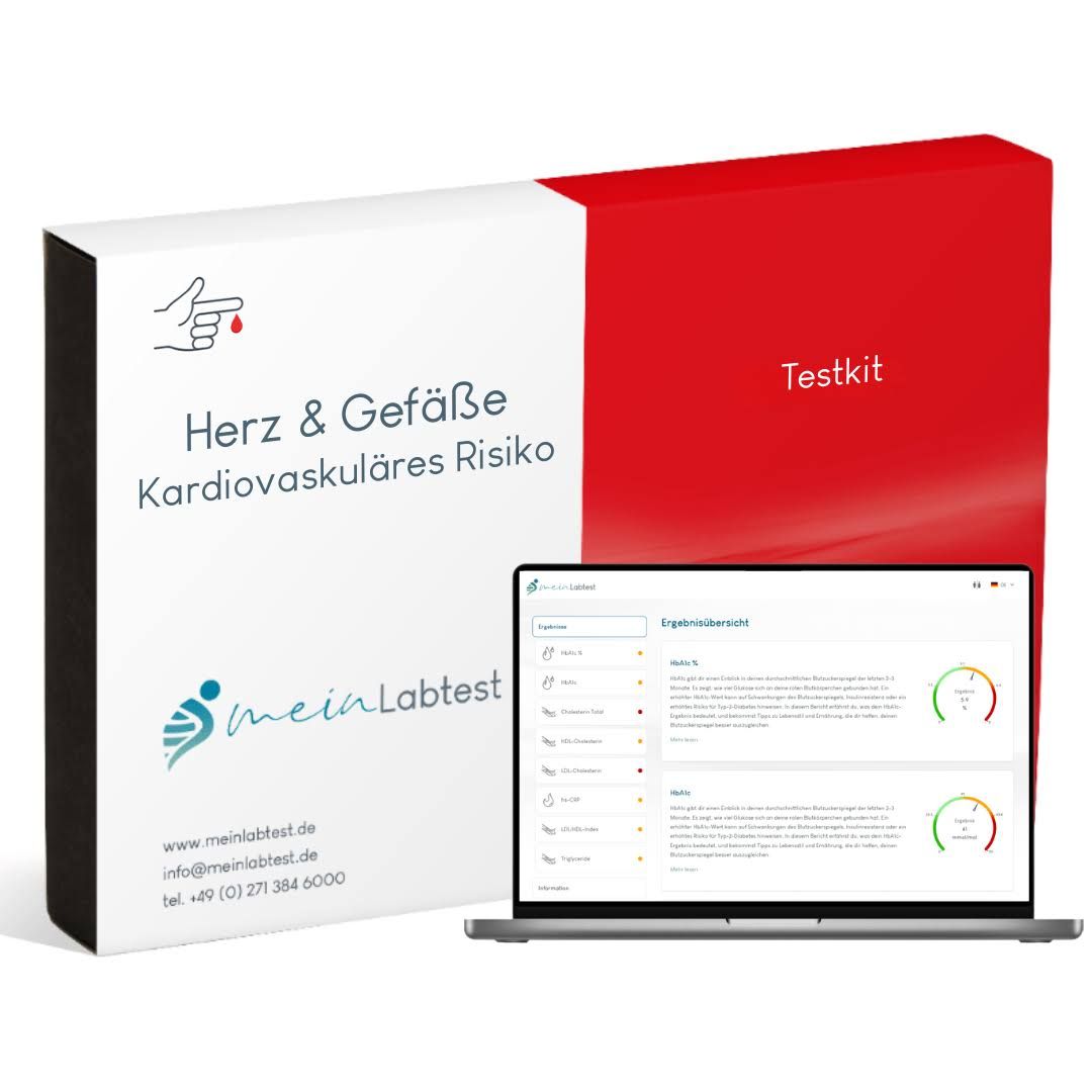 Bluttest-Verpackung und Laptop. Auf dem Laptop: Testergebnisse. Logo: meinLabtest. Verpackung: Herz & Gefäße, Kardiovaskuläres Risiko.