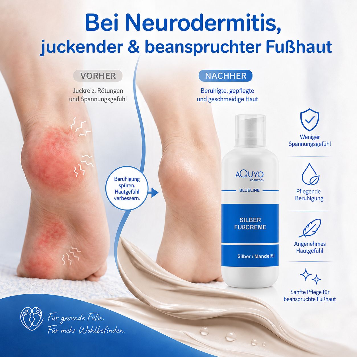 Fußcreme-Flakon mit blauem Etikett. Füße mit Neurodermitis-Symptomen. Vorher-Nachher-Vergleich. Text: Bei Neurodermitis, juckender & beanspruchter Fußhaut.